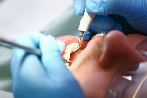 Best Urgent Dental Care for Toothache in Russellville, AL
